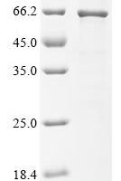 Klebsiella pneumoniae Maltoporin (lamB) Recombinant Protein - BioCrest Sci
