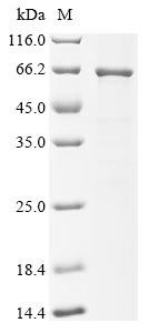Klebsiella pneumoniae Maltoporin (lamB) Recombinant Protein, Klebsiella pneumoniae, E.coli, N-terminal 6xHis-SUMO-tagged, 63.5 kDa, purity >≥ 85% as determined by SDS-PAGE.