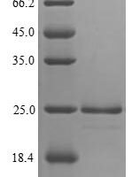 Avena sativa Endochitinase, partial Recombinant Protein, N-His/C-Myc - BioCrest Sci