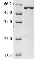 Thermus aquaticus DNA polymerase I, thermostable (polA), partial Recombinant Protein, N-His, aa 293–832 (I614,L616I) - BioCrest Sci
