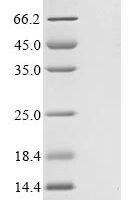 Human IgA-inducing protein homolog (IGIP) Recombinant Protein, N-His - BioCrest Sci