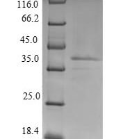 Rat Lutropin-choriogonadotropic hormone receptor (Lhcgr), partial Recombinant Protein, N-His, aa 27–362, Yeast - BioCrest Sci