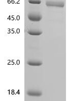 Human Natural cytotoxicity triggering receptor 1(NCR1), partial Recombinant Protein - BioCrest Sci