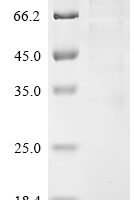 Rat Disks large homolog 4 (Dlg4) Recombinant Protein - BioCrest Sci