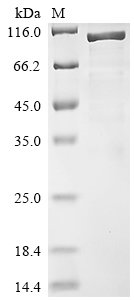 Rat Disks large homolog 4 (Dlg4) Recombinant Protein, Rattus norvegicus (Rat), E.coli, N-terminal 10xHis-tagged and C-terminal Myc-tagged, 87.9 kDa, purity >≥ 85% as determined by SDS-PAGE.