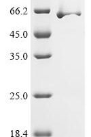 Vaccinia virus Protein OPG154 (OPG154), Biotinylated Recombinant Protein - BioCrest Sci