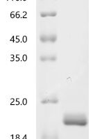 Mycobacterium bovis ESAT-6-like protein esxB (esxB) Recombinant Protein, C-His, aa 2–100, E.coli - BioCrest Sci