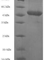 Human Pro-neuregulin-2, membrane-bound isoform (NRG2), partial Recombinant Protein - BioCrest Sci