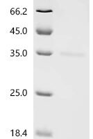Human Survival motor neuron protein (SMN1), partial Recombinant Protein - BioCrest Sci