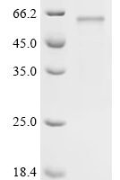 Mouse Serine/threonine-protein kinase WNK3 (Wnk3), partial Recombinant Protein - BioCrest Sci