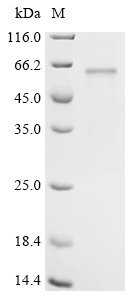 Mouse Serine/threonine-protein kinase WNK3 (Wnk3), partial Recombinant Protein, Mus musculus (Mouse), Baculovirus, C-terminal 6xHis-tagged, 50.1 kDa, purity >≥ 85% as determined by SDS-PAGE.