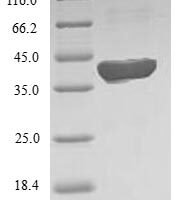 Human 5-formyltetrahydrofolate cyclo-ligase (MTHFS) Recombinant Protein - BioCrest Sci