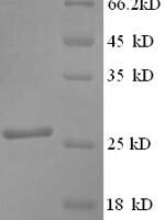 Human Synaptosomal-associated protein 25 (SNAP25) Recombinant Protein - BioCrest Sci