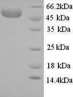 Rabbit E-selectin (SELE), partial Recombinant Protein - BioCrest Sci