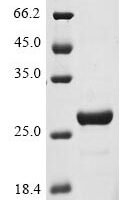 Human Coiled-coil domain-containing protein 112 (CCDC112), partial Recombinant Protein - BioCrest Sci