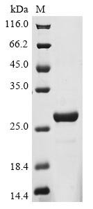 Human Coiled-coil domain-containing protein 112 (CCDC112), partial Recombinant Protein, Homo sapiens (Human), E.coli, N-terminal 10xHis-tagged, 24.3 kDa, purity >≥ 85% as determined by SDS-PAGE.