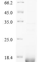 Human Prostate stem cell antigen (PSCA) Recombinant Protein, N-His, aa 12–86, E.coli - BioCrest Sci