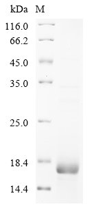 Human Prostate stem cell antigen (PSCA) Recombinant Protein, N-His, aa 12–86, E.coli, Homo sapiens (Human), E.coli, N-terminal 6xHis-tagged, 14.2 kDa, purity >≥ 85% as determined by SDS-PAGE.