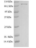 Human Neuroepithelial cell-transforming gene 1 protein (NET1) Recombinant Protein - BioCrest Sci