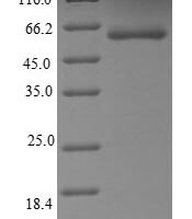 Human Hepatocyte growth factor receptor (MET) (N375S), partial Recombinant Protein - BioCrest Sci