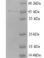 Escherichia coli Ribonucleoside-diphosphate reductase 1 subunit beta (nrdB) Recombinant Protein, N-His - BioCrest Sci