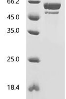 Human Collagen alpha-1(III) chain (COL3A1), partial Recombinant Protein - BioCrest Sci