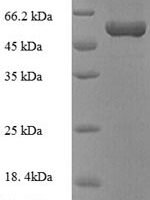 Escherichia coli Purine nucleoside phosphorylase DeoD-type (deoD) Recombinant Protein - BioCrest Sci