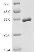 Simian retrovirus SRV-2 Gag-Pro polyprotein (pro), partial Recombinant Protein - BioCrest Sci
