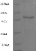 Human Interleukin-2 (IL2) Recombinant Protein, N-GST - BioCrest Sci
