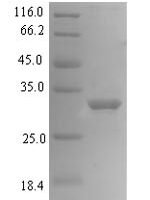 Human Mediator of DNA damage checkpoint protein 1 (MDC1), partial Recombinant Protein, N-His-SUMO - BioCrest Sci