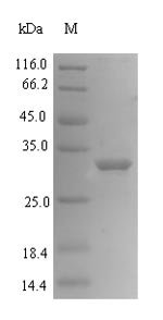 Human Mediator of DNA damage checkpoint protein 1 (MDC1), partial Recombinant Protein, N-His-SUMO, Homo sapiens (Human), E.coli, N-terminal 6xHis-SUMO-tagged, 36.9 kDa, purity >≥ 90% as determined by SDS-PAGE.