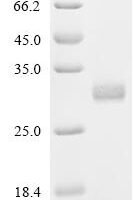 Human Calcineurin B homologous protein 1 (CHP1) Recombinant Protein, C-His, aa 2–195, Mammalian cell - BioCrest Sci