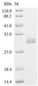 Human Calcineurin B homologous protein 1 (CHP1) Recombinant Protein, C-His, aa 2–195, Mammalian cell, Homo sapiens (Human), Mammalian cell, C-terminal 6xHis-tagged, 23.4 kDa, purity >≥ 95% as determined by SDS-PAGE.