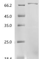 Human Flavin-containing monooxygenase 5 (FMO5) Recombinant Protein - BioCrest Sci