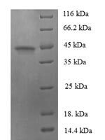 Human Protein FAM110B (FAM110B) Recombinant Protein - BioCrest Sci