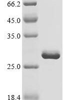 Tomato bushy stunt virus RNA silencing suppressor p19 (ORF4) Recombinant Protein - BioCrest Sci