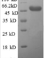 Human AFG3-like protein 2 (AFG3L2), partial Recombinant Protein - BioCrest Sci