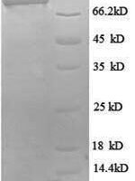 Human Probable ATP-dependent RNA helicase DDX27 (DDX27), partial Recombinant Protein - BioCrest Sci