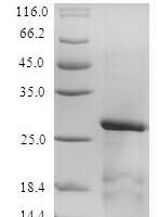 Mouse Serine protease inhibitor Kazal-type 1 (Spink1) Recombinant Protein - BioCrest Sci