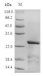 Mouse Serine protease inhibitor Kazal-type 1 (Spink1) Recombinant Protein, Mus musculus (Mouse), E.coli, N-terminal GST-tagged, 33.1 kDa, purity >≥ 90% as determined by SDS-PAGE.