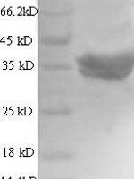 Human Talin-2 (TLN2), partial Recombinant Protein, N-His-SUMO - BioCrest Sci