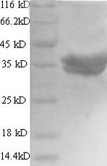 Human Talin-2 (TLN2), partial Recombinant Protein, N-His-SUMO, Homo sapiens (Human), E.coli, N-terminal 6xHis-SUMO-tagged, 53.1 kDa, purity >≥ 90% as determined by SDS-PAGE.