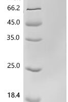 Human CD9 antigen (CD9), partial, Biotinylated Recombinant Protein - BioCrest Sci