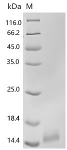 Human CD9 antigen (CD9), partial, Biotinylated Recombinant Protein, Homo sapiens (Human), Mammalian cell, C-terminal 10xHis-Avi-tagged, 13.3 kDa, purity >≥ 95% as determined by SDS-PAGE.