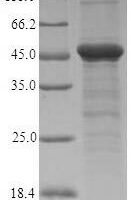 Escherichia coli Penicillin-binding protein 1A (mrcA), partial Recombinant Protein - BioCrest Sci