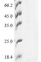 Human metapneumovirus Fusion glycoprotein F0 (F), partial Recombinant Protein - BioCrest Sci
