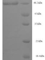 Human Septin-7 (SEPTIN7) Recombinant Protein, N-His-SUMO - BioCrest Sci
