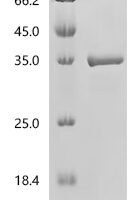 Mouse Biliverdin reductase A (Blvra) Recombinant Protein, C-His, aa 3–295, Yeast - BioCrest Sci