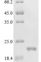 Human Ragulator complex protein LAMTOR3 (LAMTOR3) Recombinant Protein, C-His - BioCrest Sci