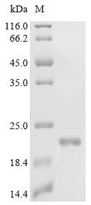 Human Ragulator complex protein LAMTOR3 (LAMTOR3) Recombinant Protein, C-His, Homo sapiens (Human), E.coli, C-terminal 6xHis-tagged, 19.7 kDa, purity >≥ 95% as determined by SDS-PAGE.